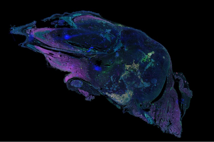 Multiplex tissue image after background and artifact removal